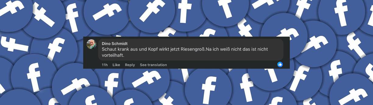 Nutzer zeigt sich besorgt über Wussows Veränderung | Quelle: Facebook/Bild