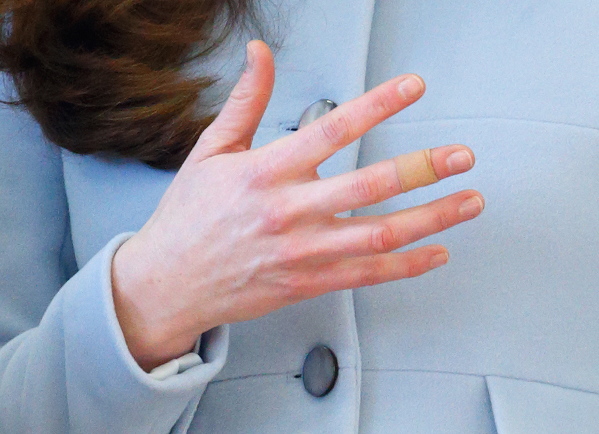 Eine Nahaufnahme von Prinzessin Catherines bandagiertem Finger bei ihrem Besuch der Kensington Aldridge Academy in London, England am 19. Januar 2015 | Quelle: Getty Images