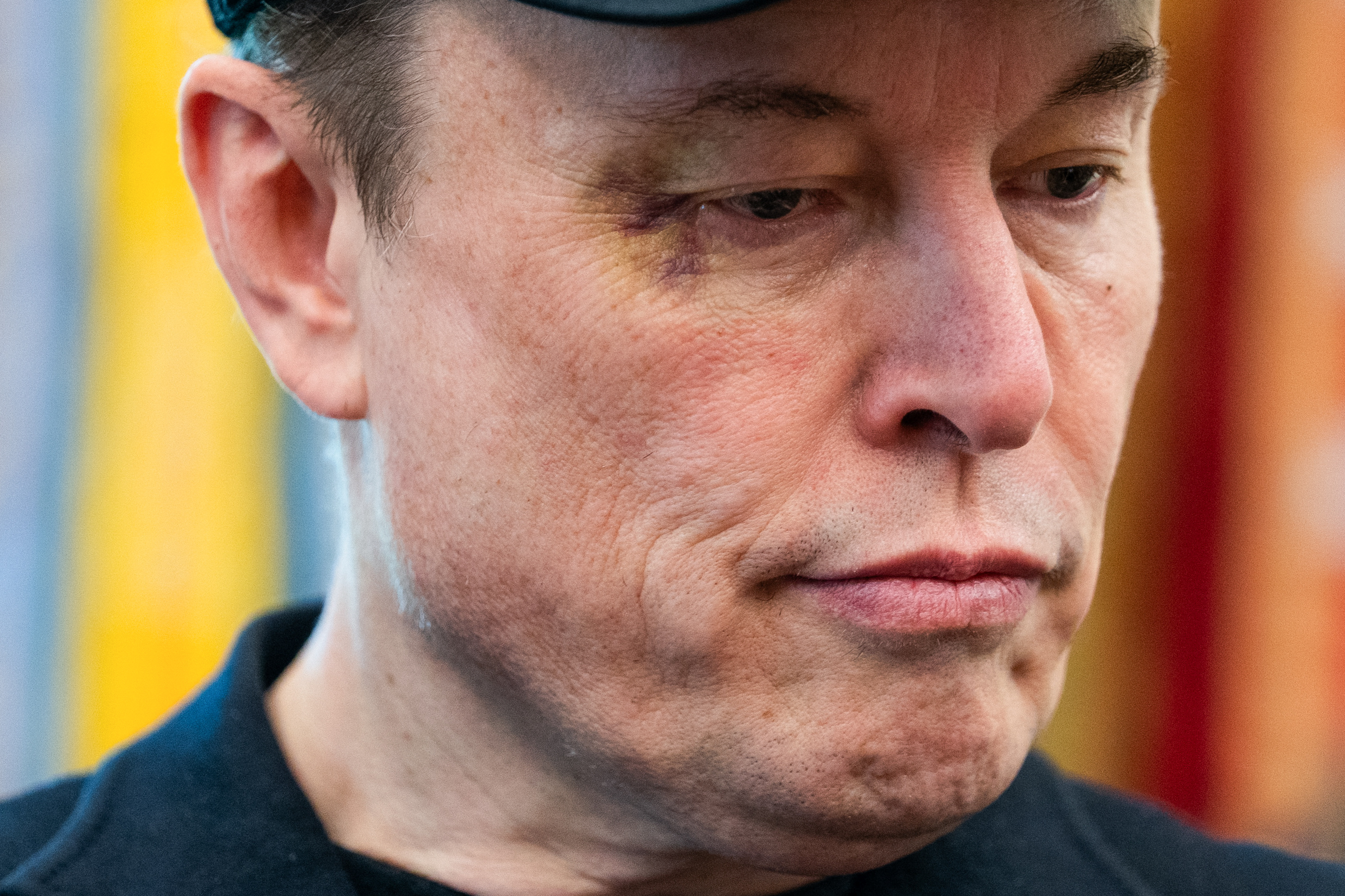 Als er auf die Verletzung angesprochen wurde, erklärte Musk beiläufig, dass sie das Ergebnis einer Rangelei mit seinem fünfjährigen Sohn X Æ A-12 war.