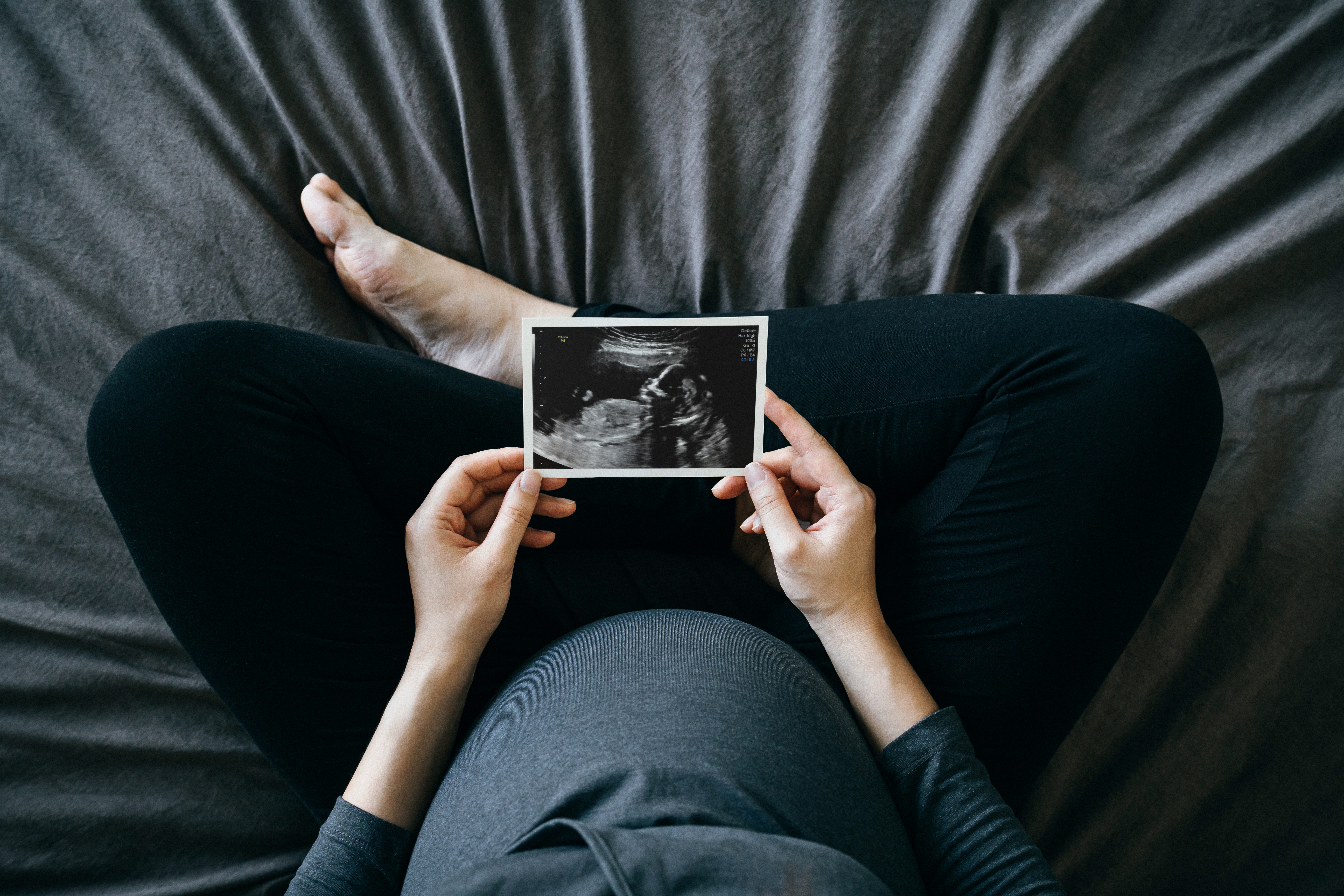 Eine schwangere Frau sitzt auf ihrem Bett und hält ein Ultraschallbild in der Hand | Quelle: Shutterstock