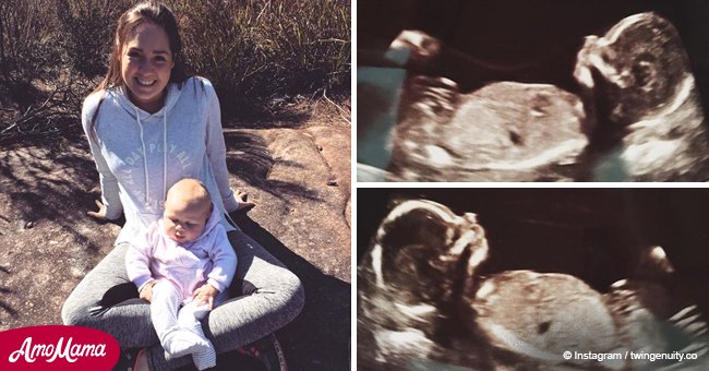 6 Wochen nach der Geburt ihrer Tochter erfuhr sie, dass sie wieder schwanger ist 