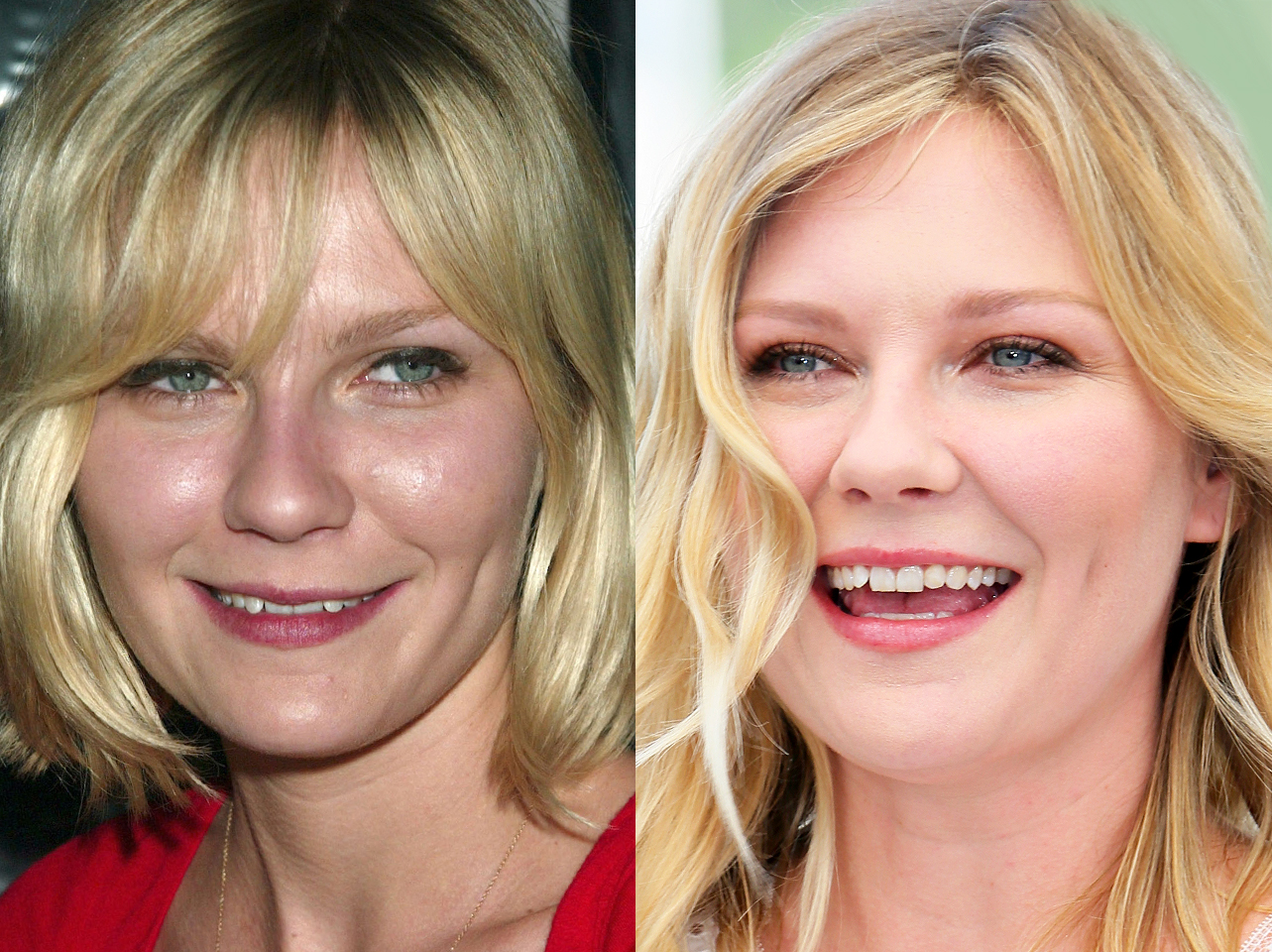 Ein Vorher-Nachher-Bild von Kirsten Dunsts Lächeln. | Quelle: Getty Images