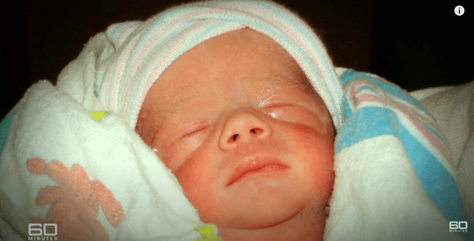 Baby Logan nach der Geburt. | Quelle: Youtube.com/60 Minutes Australia