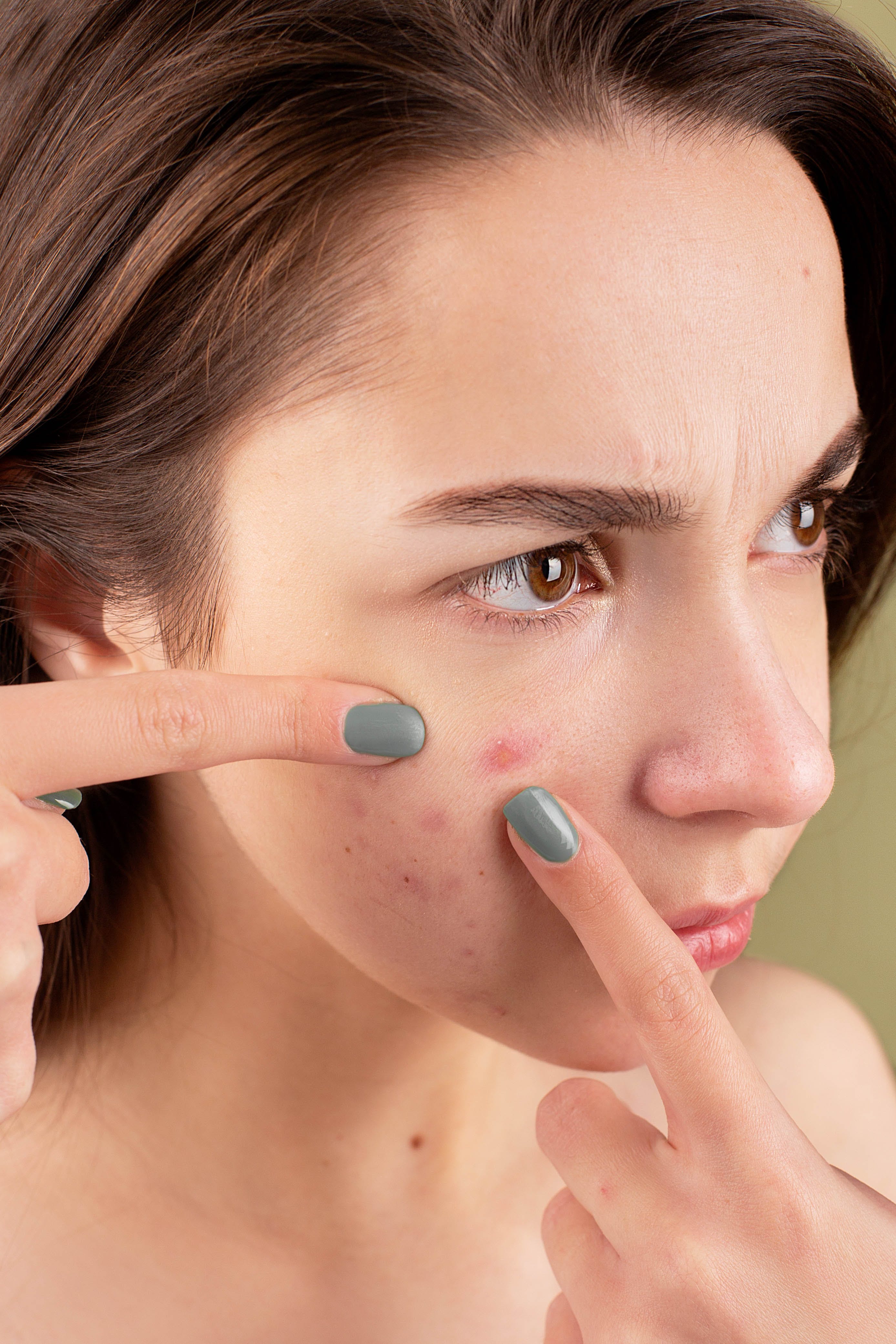 Eine Frau, die einen Pickel im Gesicht ausquetscht | Quelle: Pexels