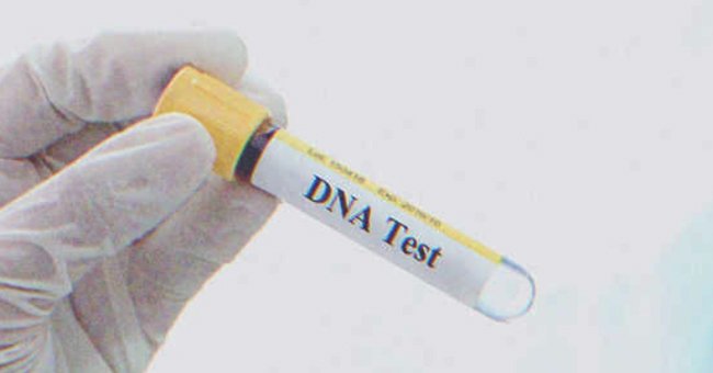 DNA-Test | Quelle: Shutterstock