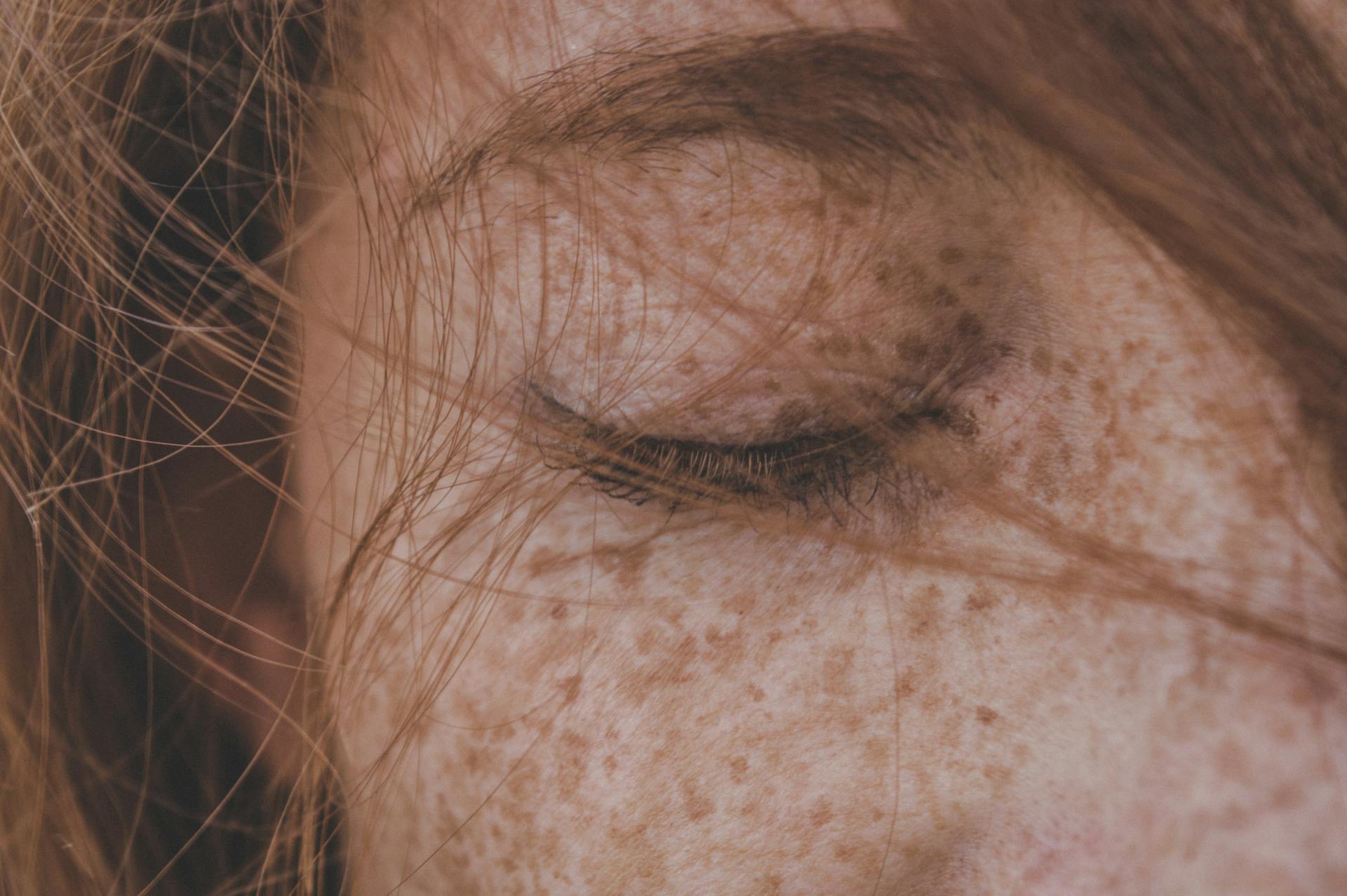 Eine Nahaufnahme der Sommersprossen einer Frau | Quelle: Pexels