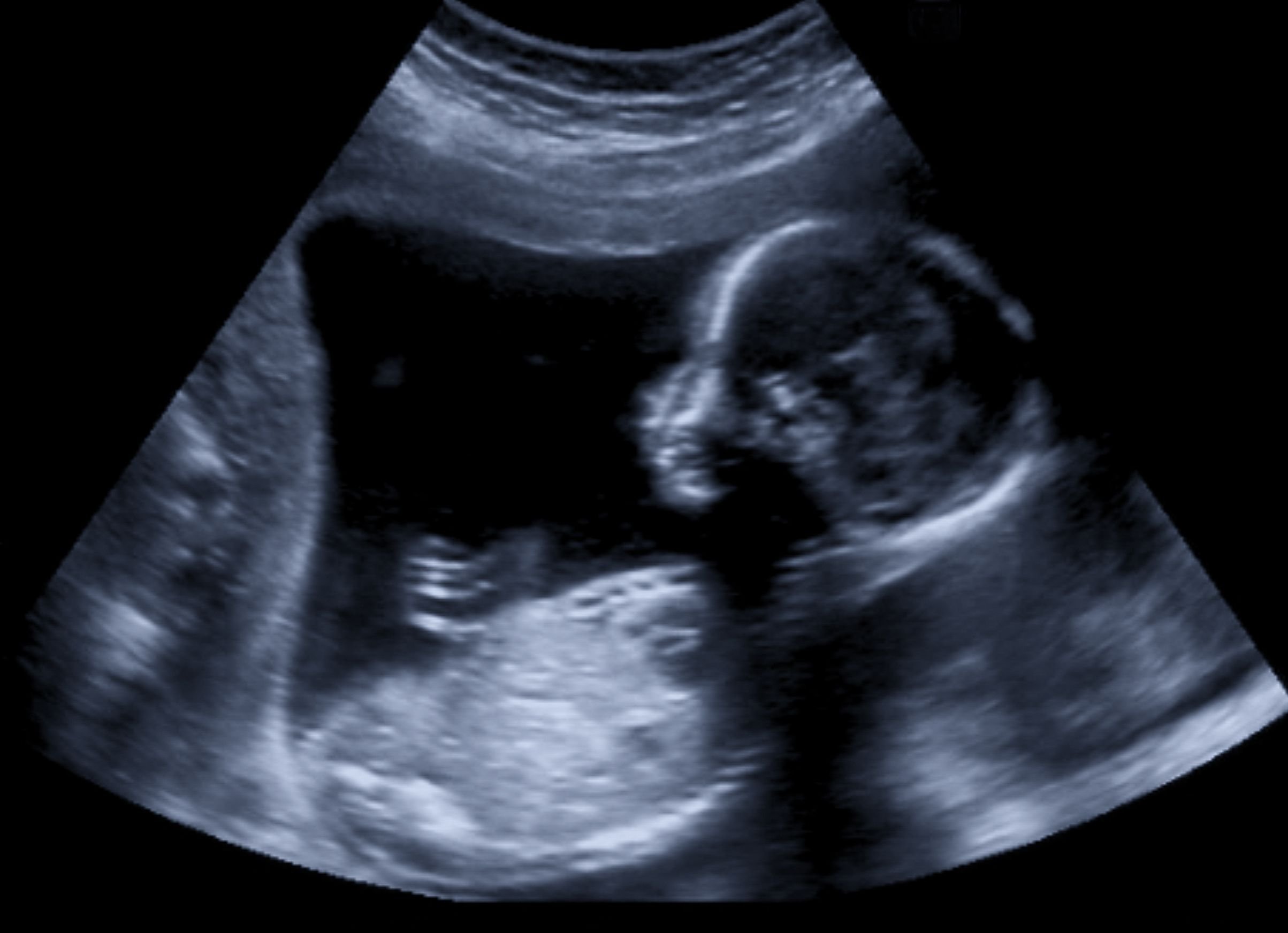 Ein Ultraschall eines ungeborenen Kindes. | Quelle: Shutterstock