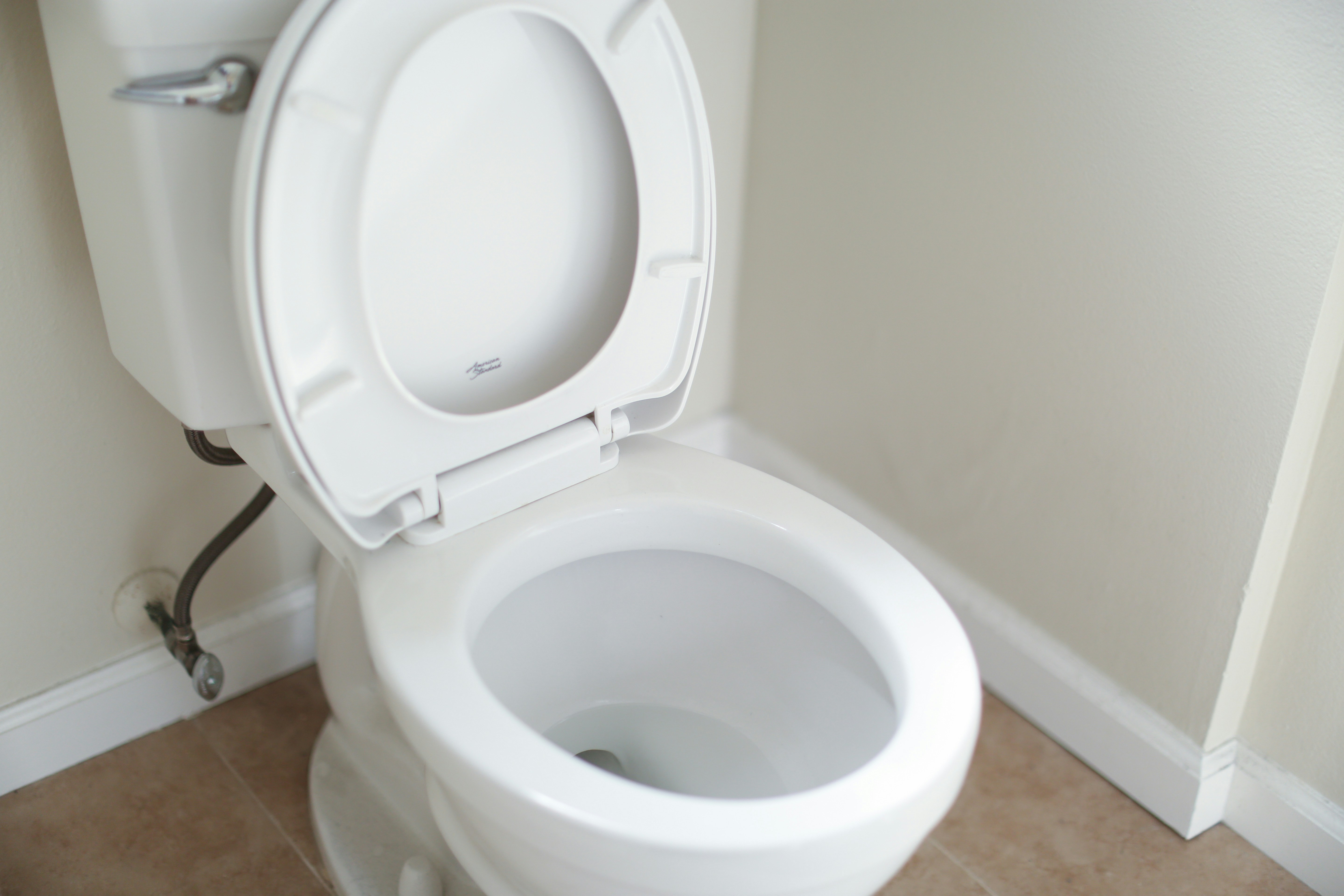 Eine Nahaufnahme einer weißen Keramiktoilette | Quelle: Unsplash