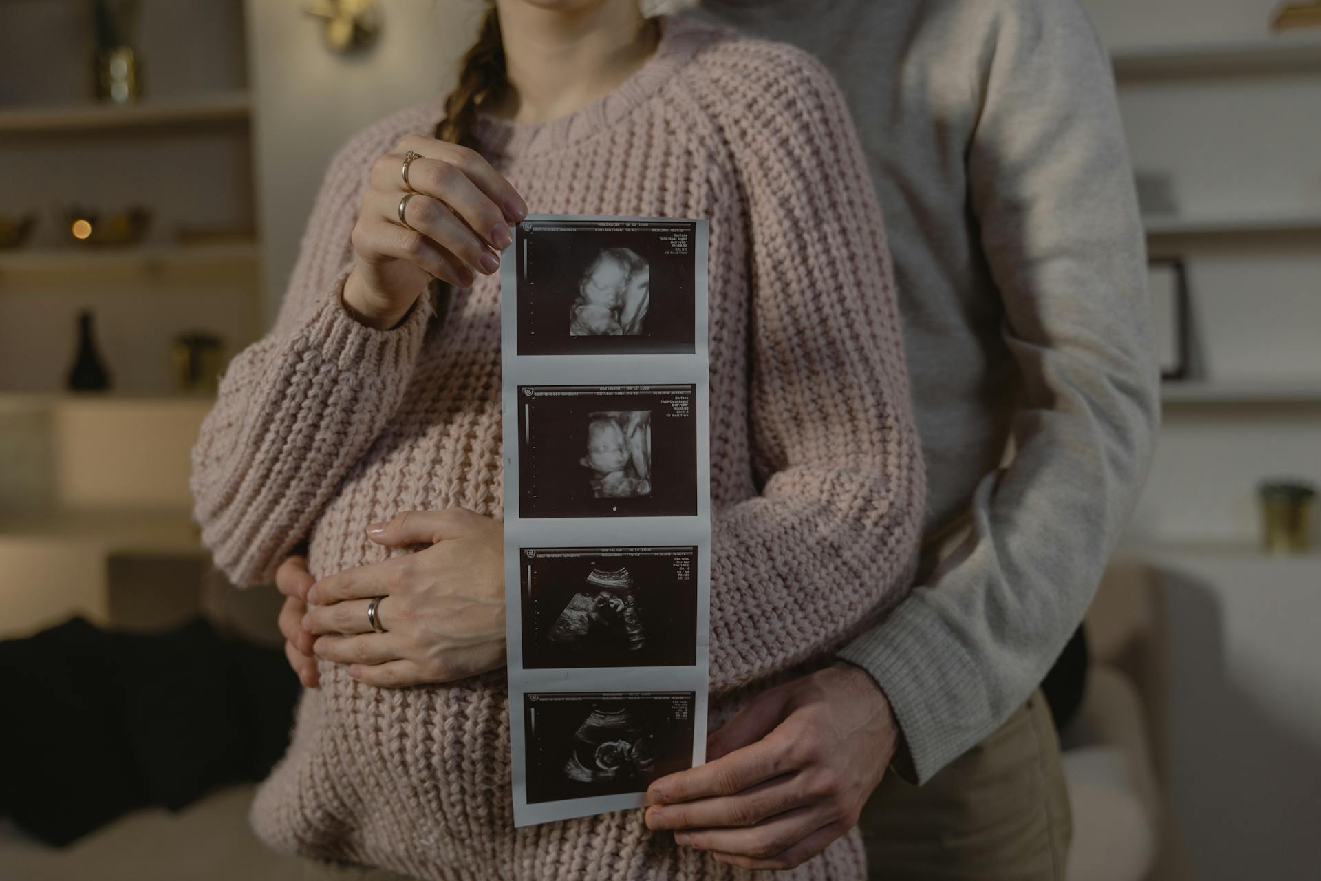 Ein schwangeres Paar hält ein Ultraschallbild in der Hand | Quelle: Pexels