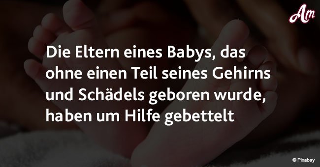 Die Eltern eines Babys, das ohne einen Teil ihres Gehirn und Schädels geboren wurde, haben um Hilfe gebettelt