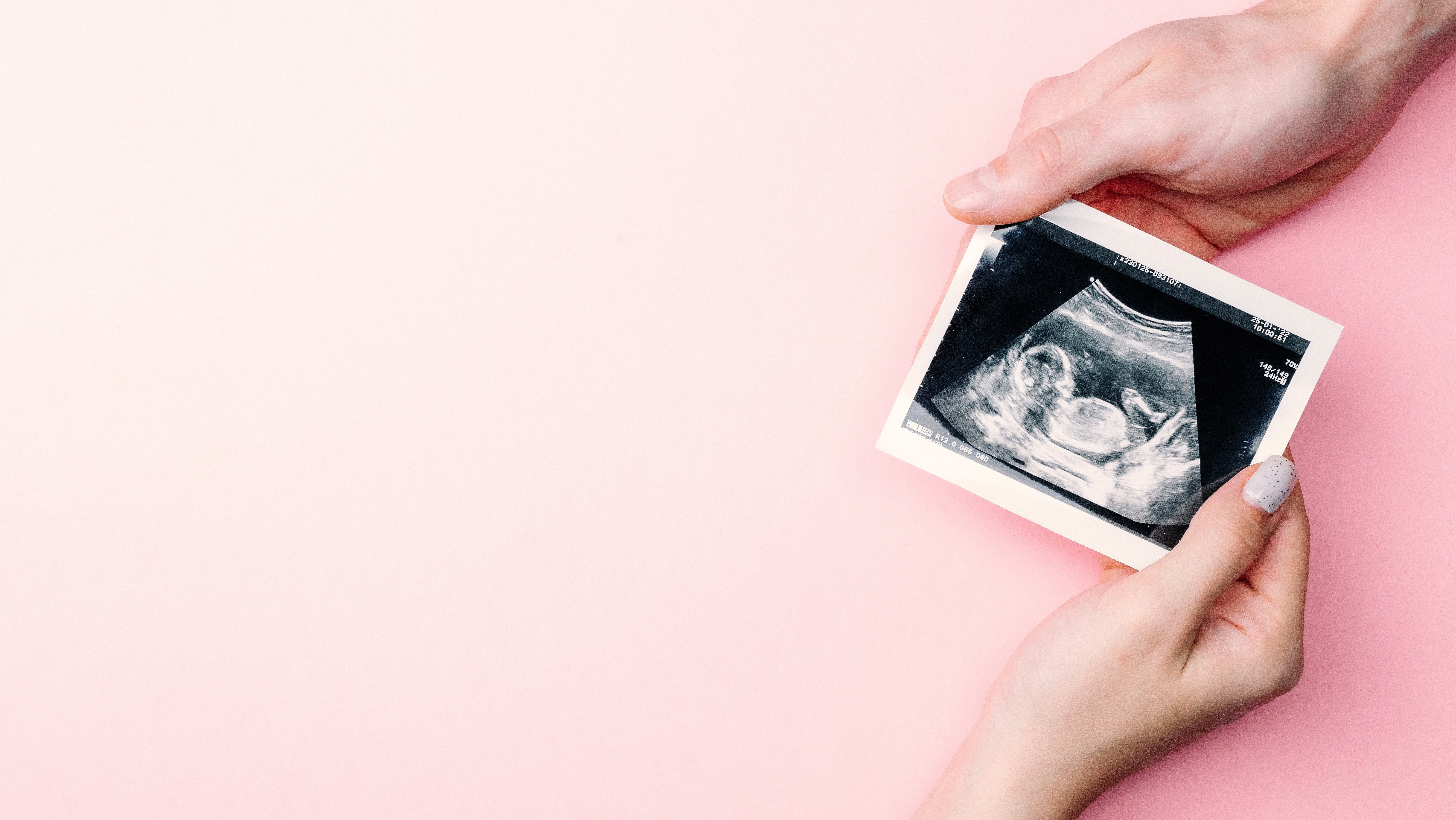 Ultraschallbild schwangeres Baby Foto | Quelle: Shutterstock