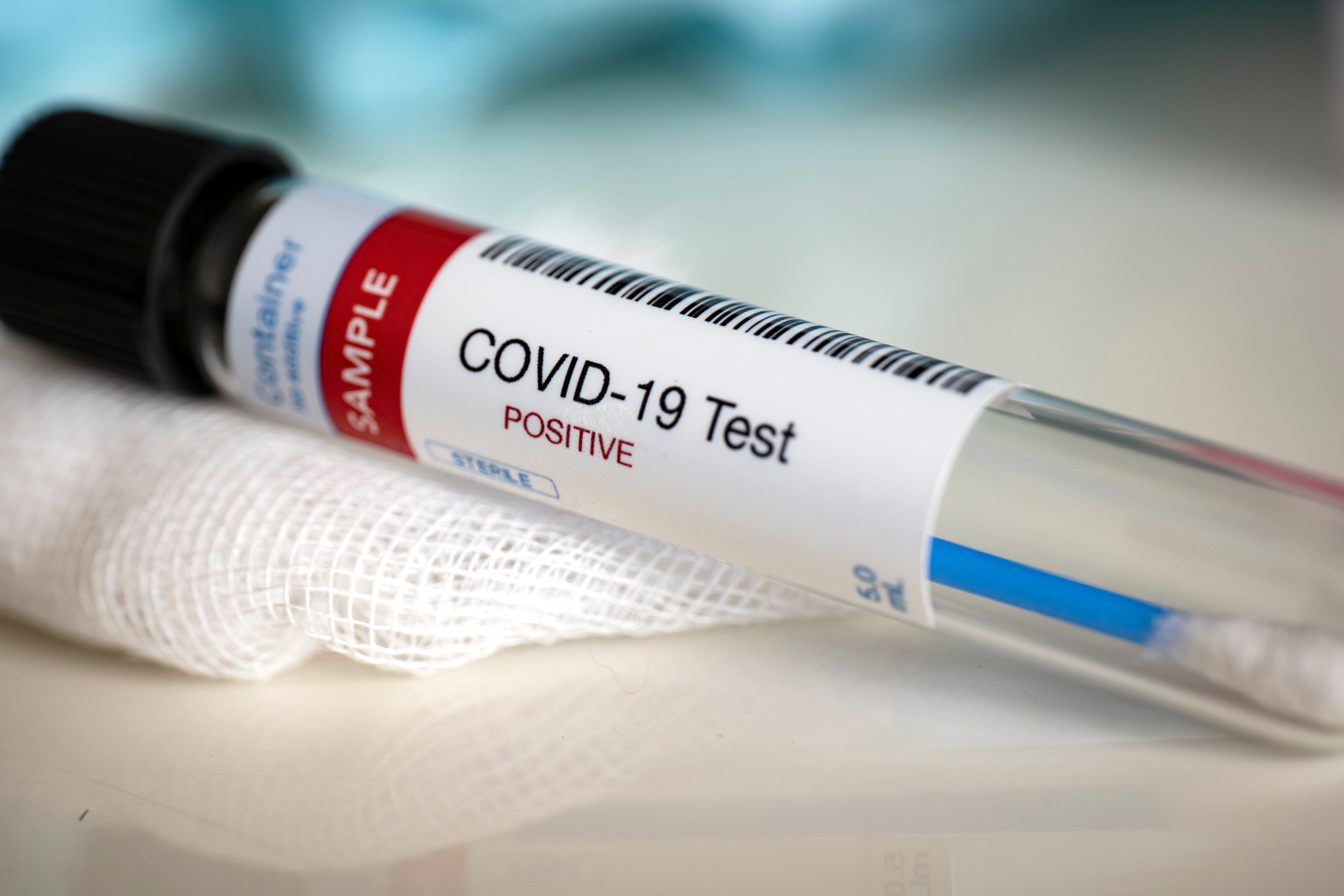 Testen auf das Vorhandensein des Coronavirus. | Quelle: Shutterstock