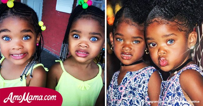 Diese Mädchen wurden als die schönsten Zwillinge der Welt bezeichnet. Hier ist, wie sie heute aussehen