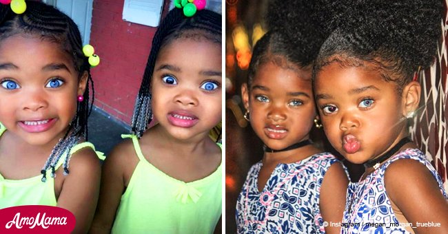 Die Mädchen, die als schönste Zwillinge der Welt bezeichnet wurden, sind größer geworden