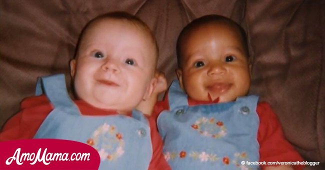 Zwillinge wurden mit unterschiedlichen Hautfarben geboren. Aber 18 Jahre später glaubt keiner, dass sie Schwestern sind