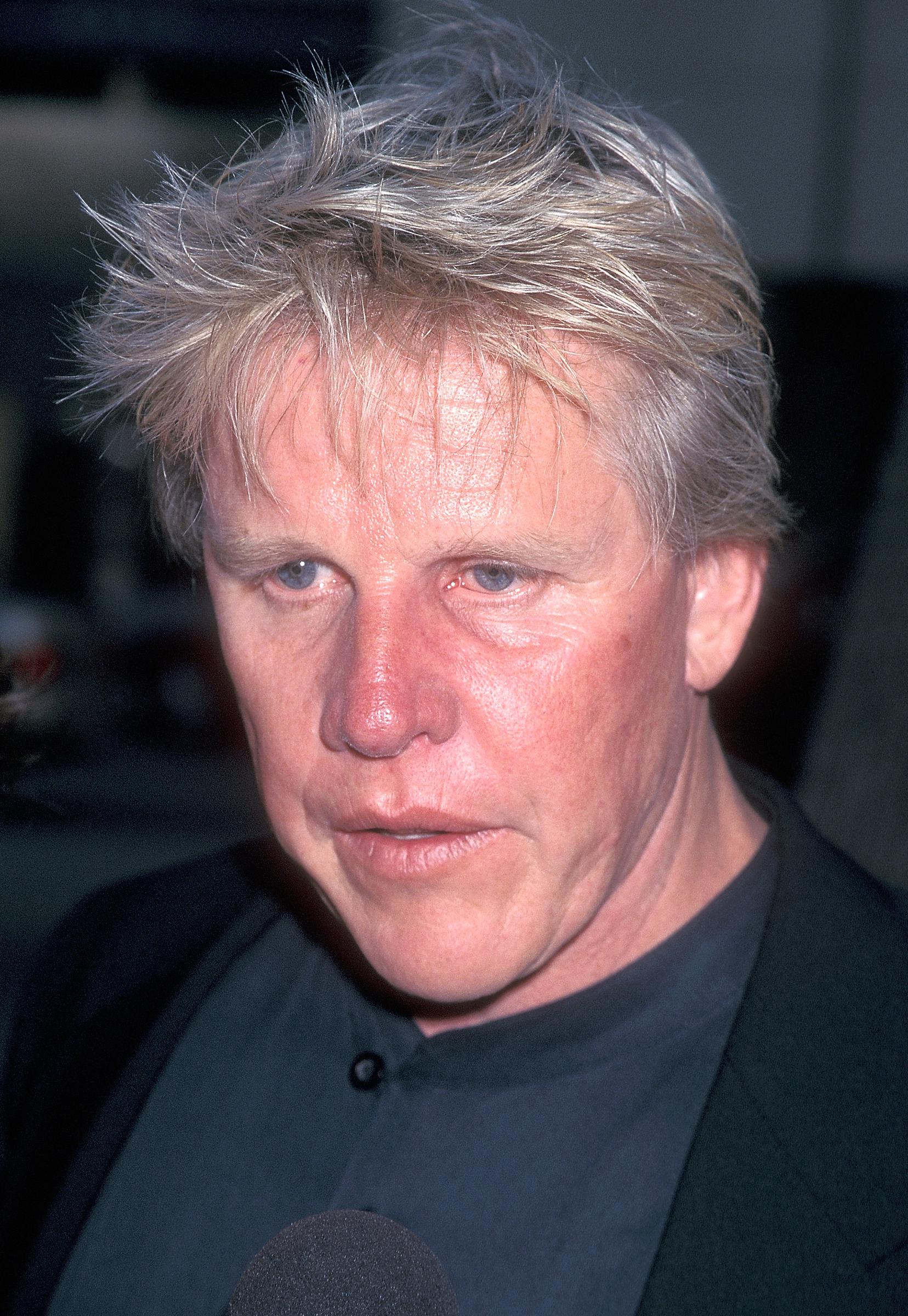 Die Krankheit führte zu einer Gesichtsoperation, die schließlich Gary Busey's körperliches Aussehen veränderte. | Quelle: Getty Images