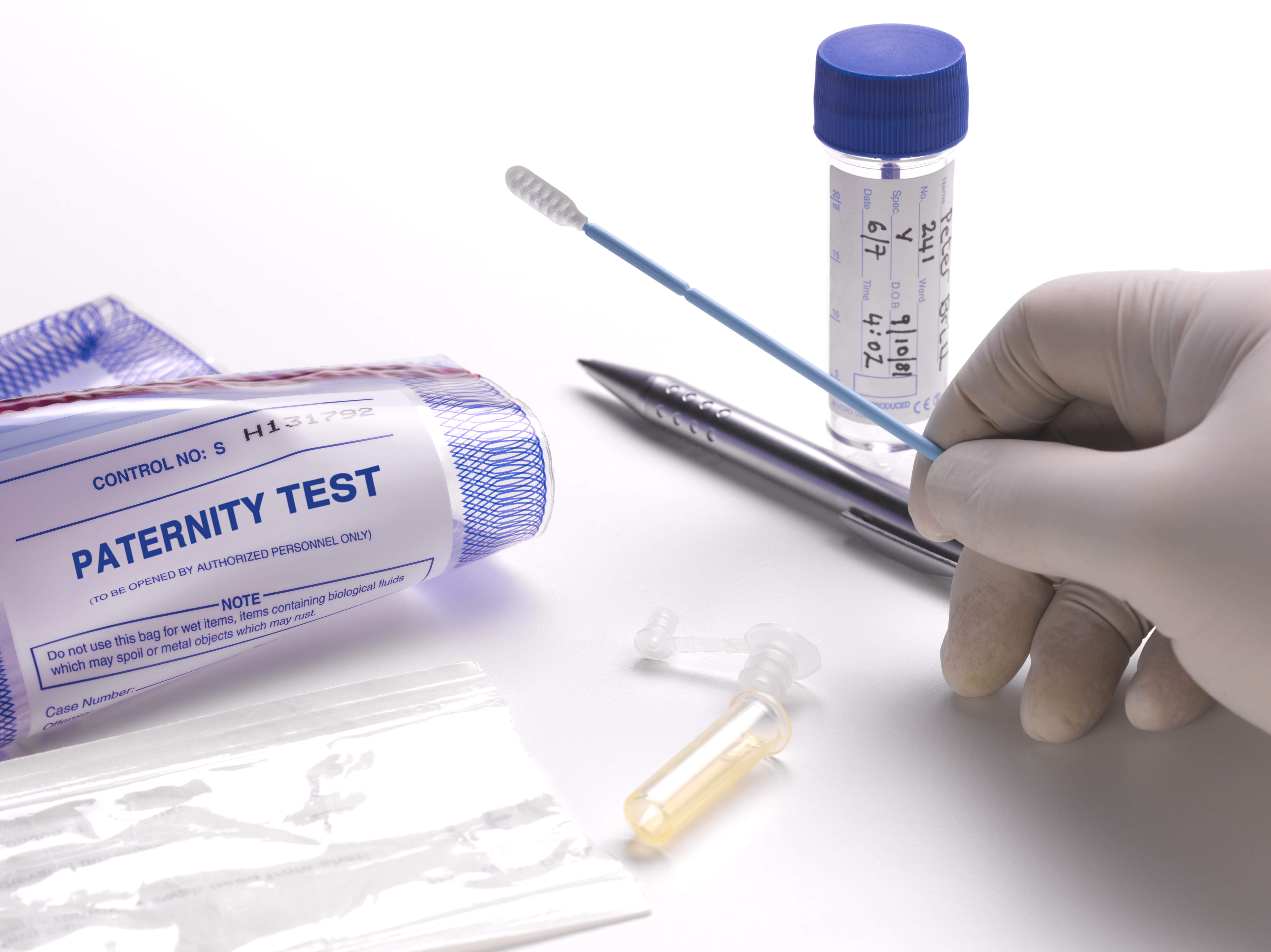 Entnahme eines DNA-Abstrichs für einen Vaterschaftstest | Quelle: Getty Images