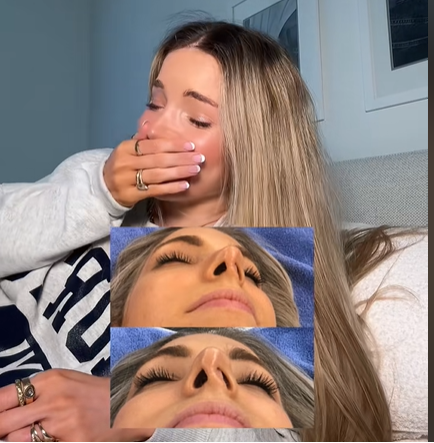 Ein Blick auf Isabelle Lux' kollabiertes Nasenloch, zu sehen in einem Beitrag vom 14. April 2025 | Quelle: TikTok/@isabelle.lux