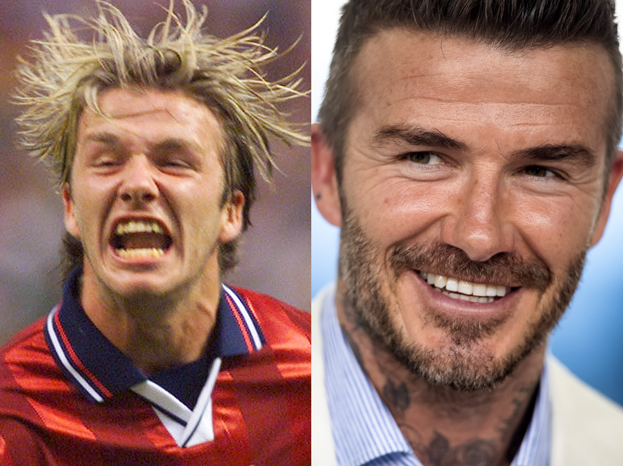 Ein Vorher-Nachher-Bild von David Beckhams Lächeln. | Quelle: Getty Images