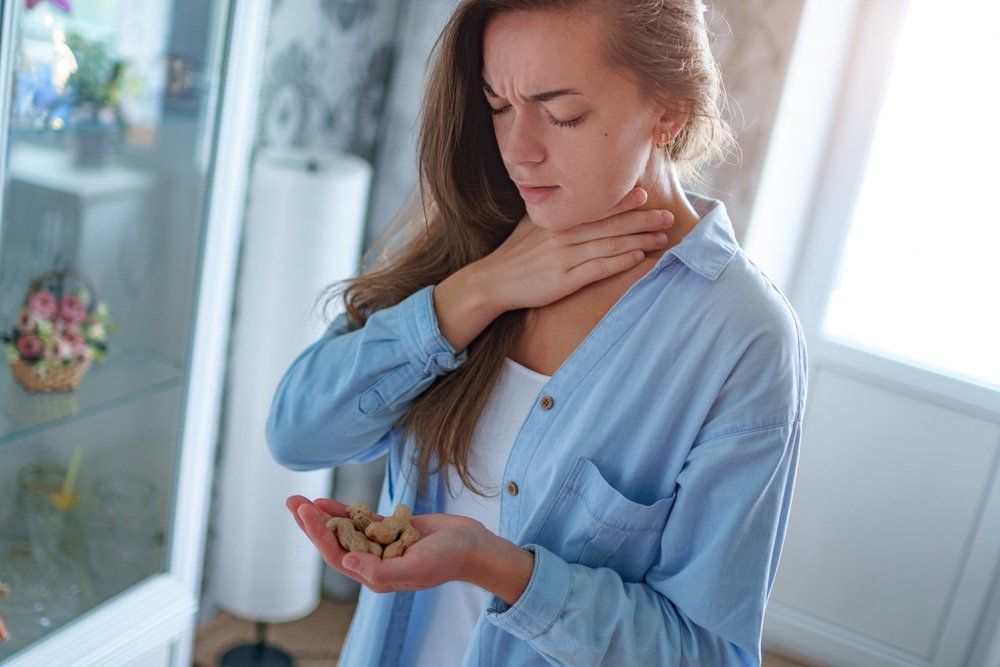 Eine allergische Reaktion auf Erdnüsse. | Quelle: Shutterstock