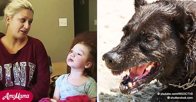 4-jähriges Mädchen verlor beinahe ihr Auge, nachdem der Familienhund sie angriff