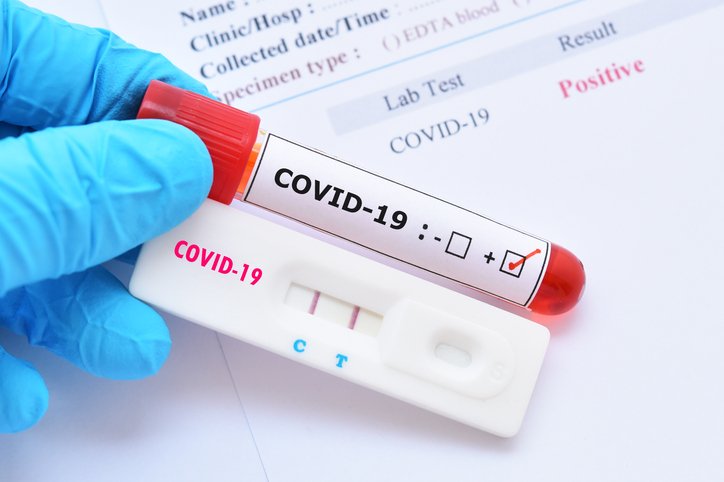 Positives Testergebnis unter Verwendung eines Schnelltestgeräts für das COVID-19-Virus | Foto: Getty Images