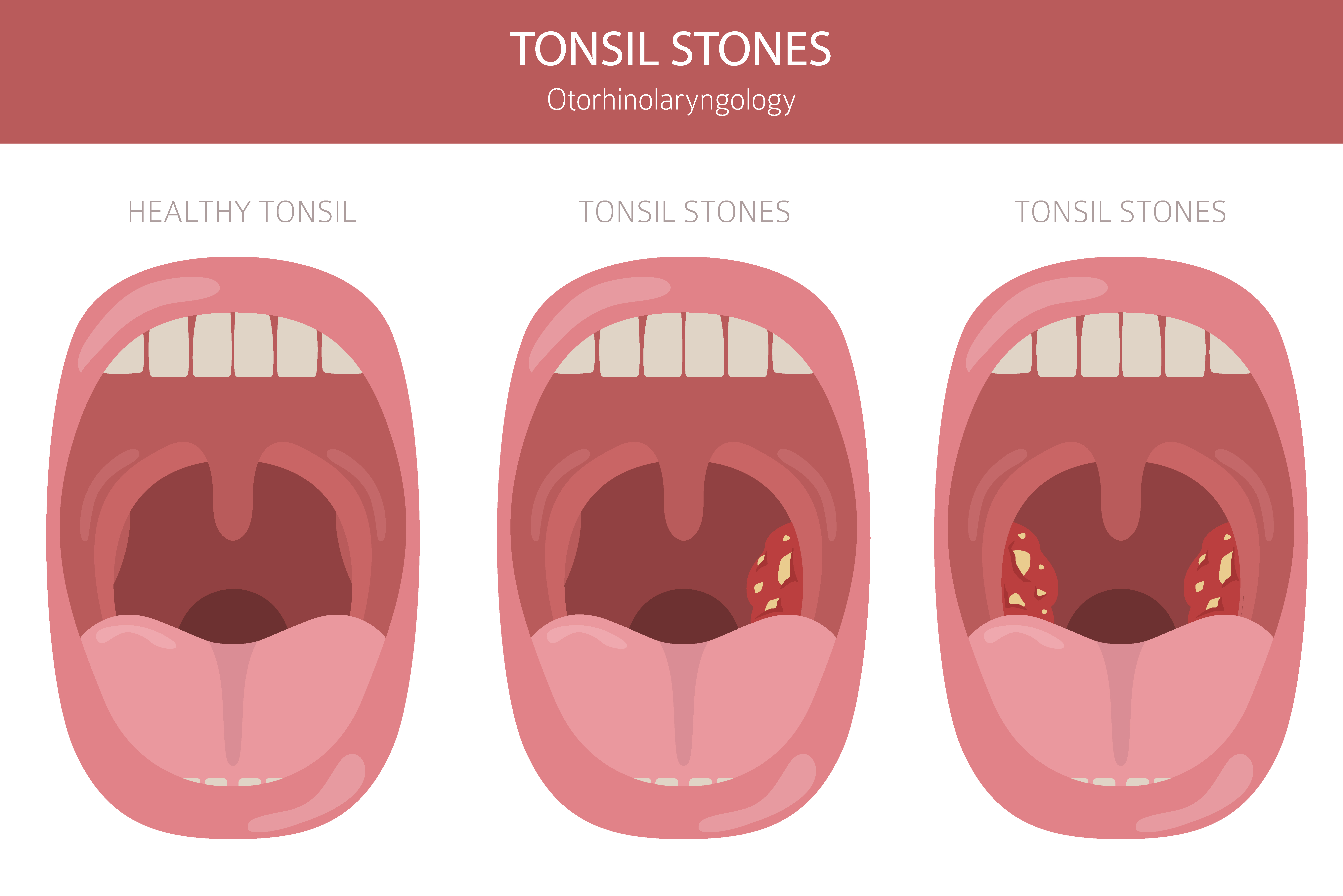 Vektorielle Illustration von Mandelsteinen | Quelle: Getty Images