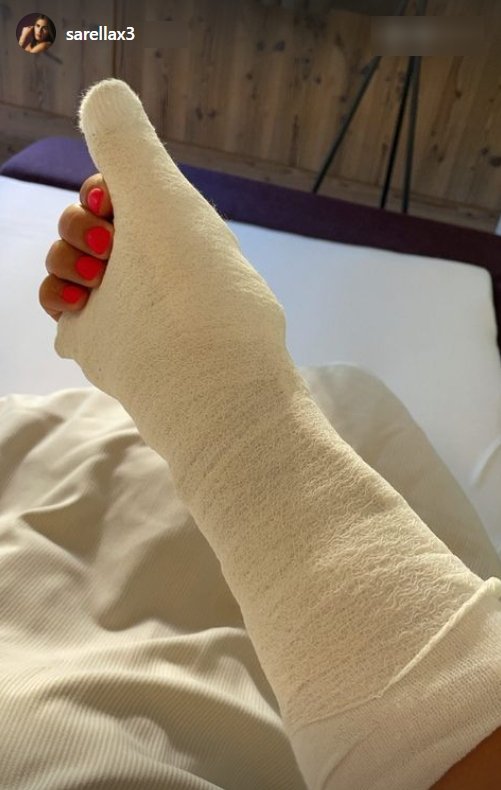 Sarah Engels zeigt ihr gebrochenes Arm in ihrer Instagram-Story. I Quelle: instagram.com/sarallax3