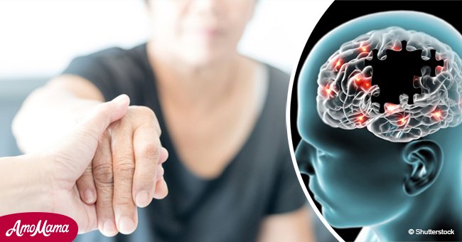 Alzheimer betrifft 1,4 Millionen Menschen in Deutschland: dies muss Sie warnen