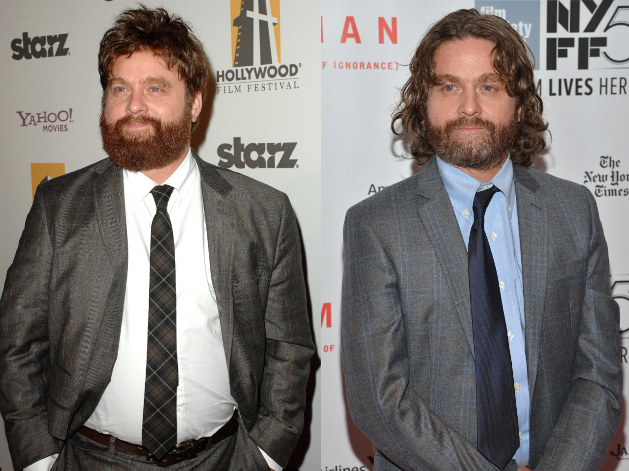 Zach Galifianakis' Verwandlung, vor und nach seinem beeindruckenden Gewichtsverlust | Quelle: Getty Images