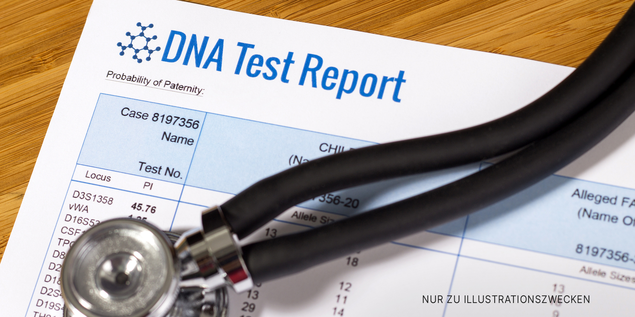 Ein DNA-Test mit einem Stethoskop oben drauf | Quelle: Shutterstock
