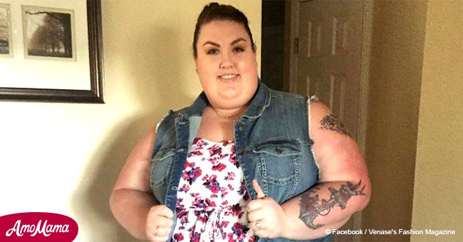 Eine Frau verlor mehr als 77 kg. Ihr Körper und Gesicht haben sich gewaltig verändert