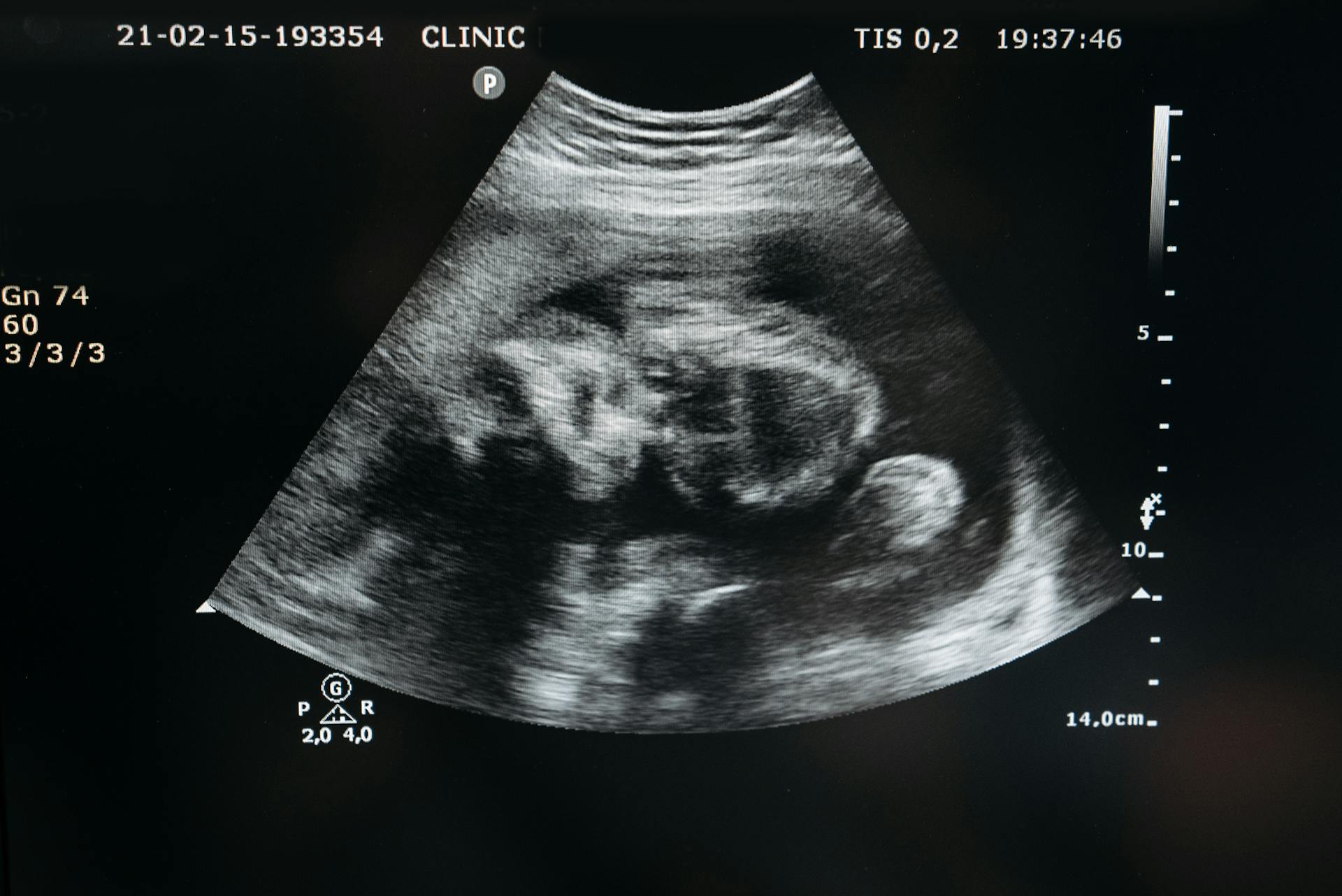 Sonogramm eines Babys | Quelle: Pexels