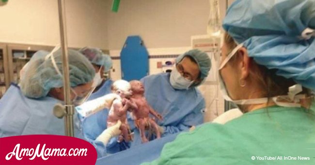 Eine Mutter bringt Zwillinge auf die Welt. Plötzlich verstehen die Ärzte, dass die Babys sich weigern, getrennt zu werden