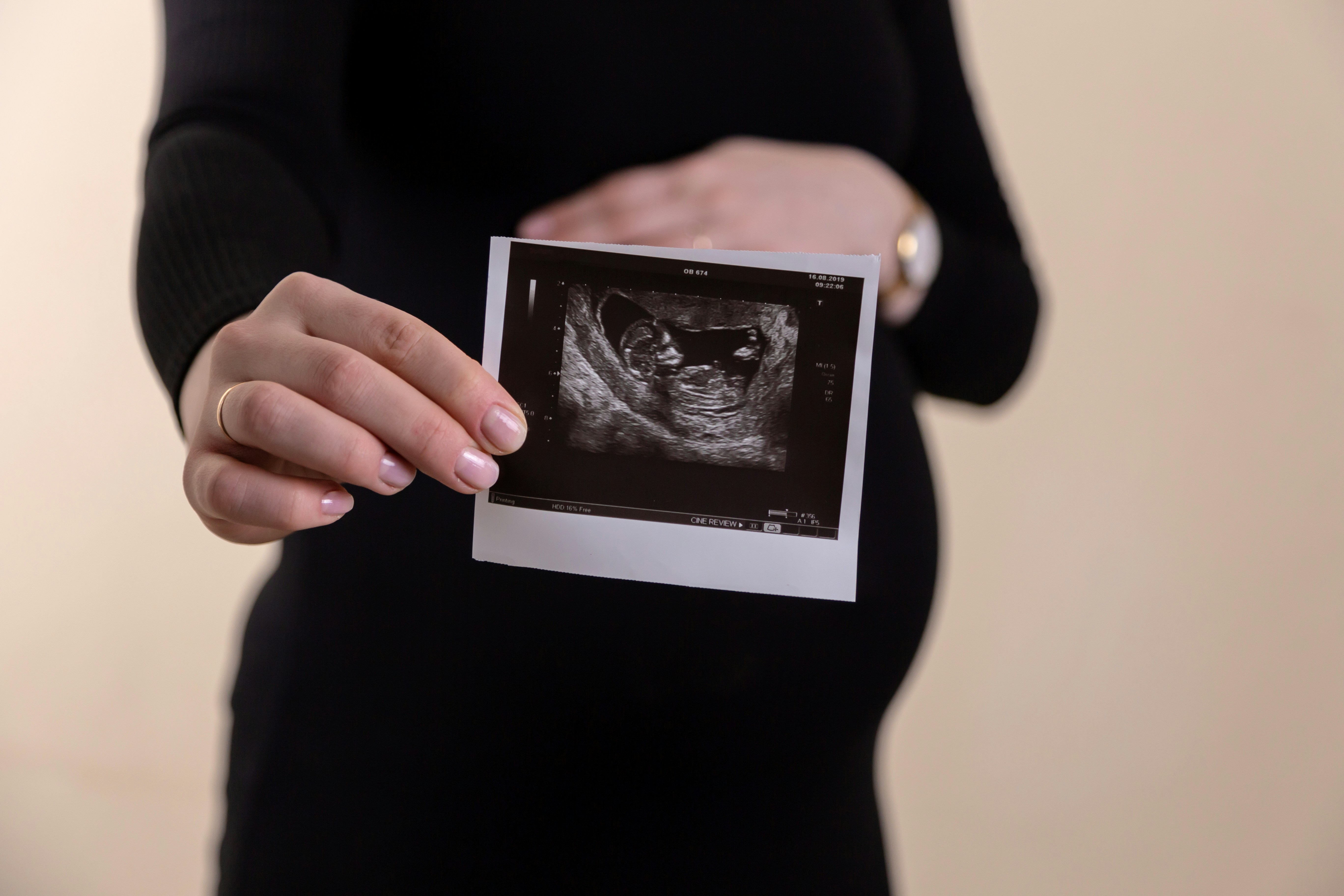 Eine Person mit einem Ultraschallgerät | Quelle: Unsplash