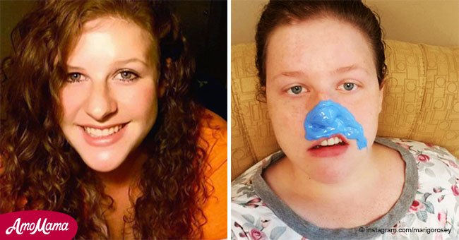 Eine junge Frau warnt alle, nachdem ein „Pickel“ auf ihrem Gesicht sich als tödlicher Krebs herausstellte