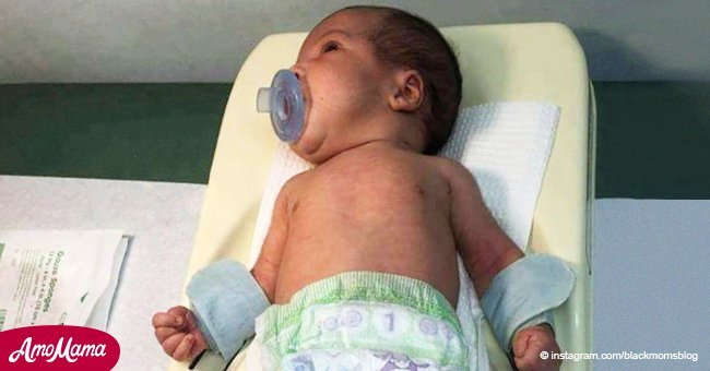 Ein Baby, das für seine Beschneidung festgeschnallt wurde, hat zu Debatten zwischen den Eltern geführt (Foto)
