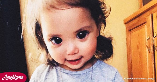Die großen schönen Augen dieses kleinen Mädchens sind das Ergebnis einer seltenen Erkrankung